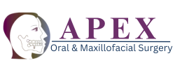 APEX